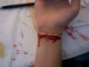 Slit Wrist